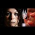 They Thought She Was Insane: Doctor Finds RFID Chip In Sex Trafficking Victim