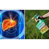 New Study Finds Strong Link Between Glyphosate & Human Liver Disease