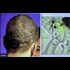 Head Scars of Obama 100% Match Akhenaten Hieroglyph! Pharaoh Returning for End Times (Videos)
