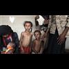 PBS Report from Yemen: As Millions Face Starvation, American-Made Bombs Are Killing Civilians