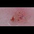 Chemtrail Critters Live on Camera! Watch These Artificial Lifeforms Wiggle! They Get Into Your Skin and Itch... Remove Them With Special Bath | Alternative