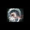 Jeff & Cliff Mickelson - Morgellons Nano Fibers And Nano Smart Dust