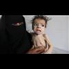 Yemeni Journalist: Saudi Arabia's Total Blockade on Yemen is