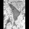 Stem cells from endometrium tissue