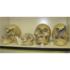 Smithsonian Admits to Destruction of Thousands of Giant Human Skeletons in Early 1900's XPost from v/FolkishAsatru