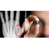 Bill Making It Illegal to Forcefully Microchip Employees Passes in Michigan House