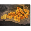 Is new Bill Gates-funded program to offer home-testing kits for coronavirus part of a larger plan?