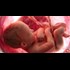 Are Toxic Chemicals Turning Boys Into Girls?
