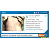 The Horrifying Measles Outbreak Nightmare Is Finally Over!