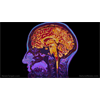 5G radiation causes BEHAVIOR changes in humans, causes ion potentiation poisoning of brain cells, leading to mass insanity